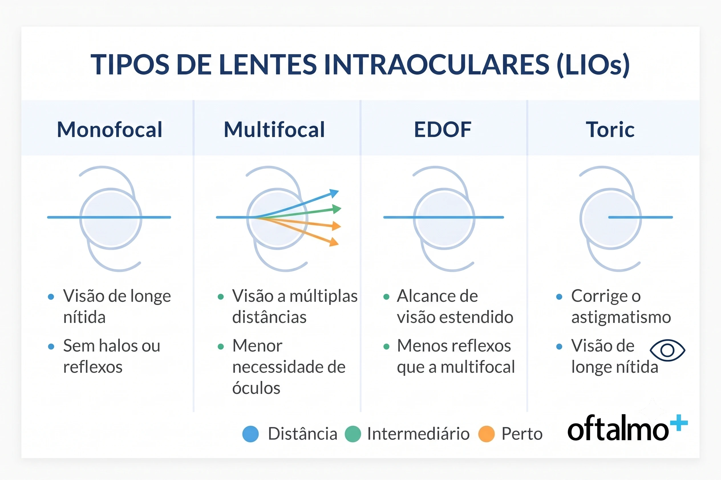 Comparação entre lentes intraoculares monofocal, multifocal, EDOF e tórica